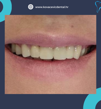 Slider image (7) Dr. Aleksandar Kovacevic - Dental Clinic in Croatia